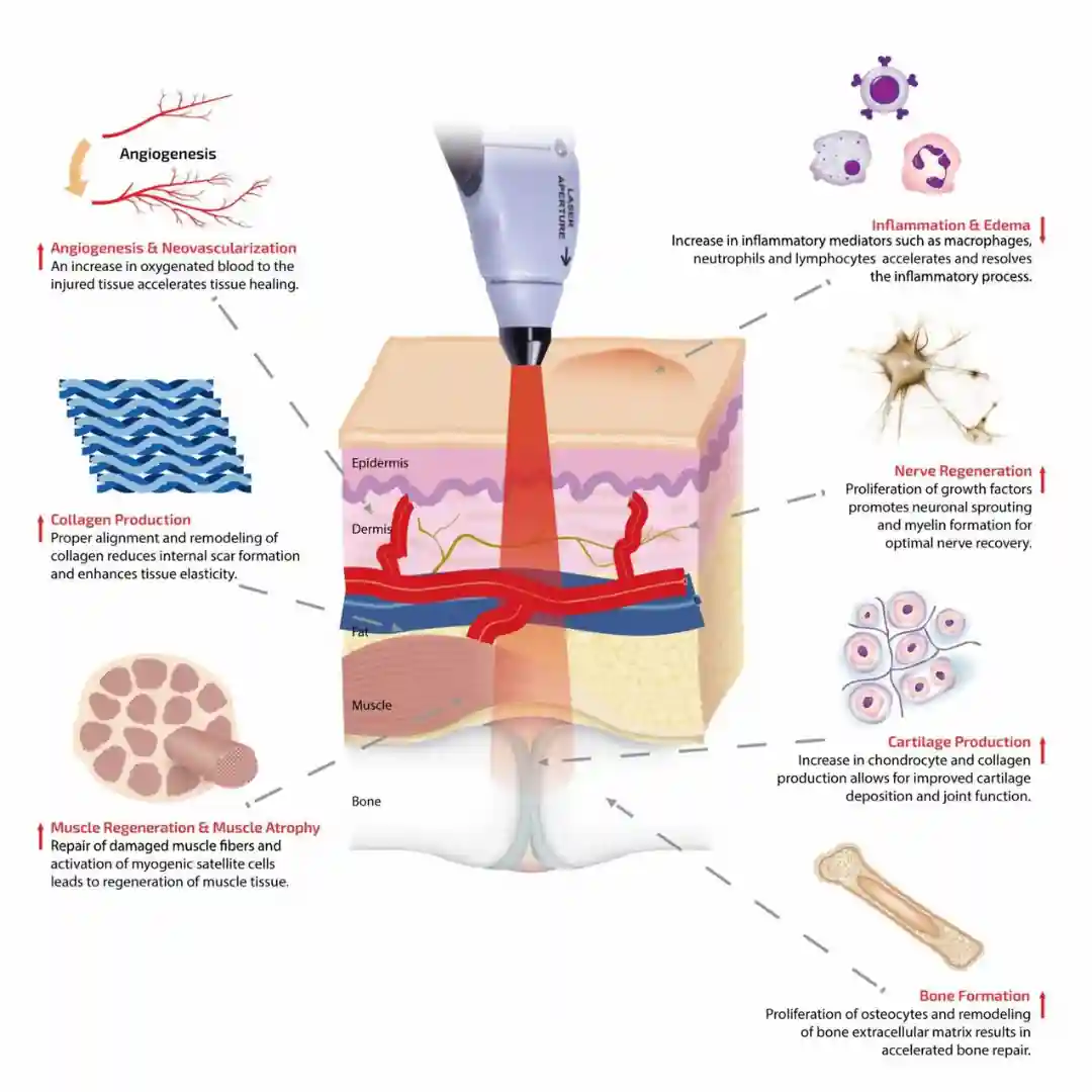 Laser Therapy 2